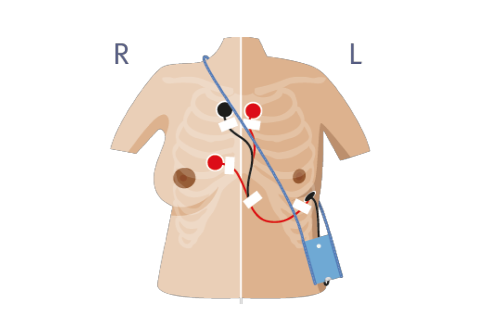 ecg-stap-4