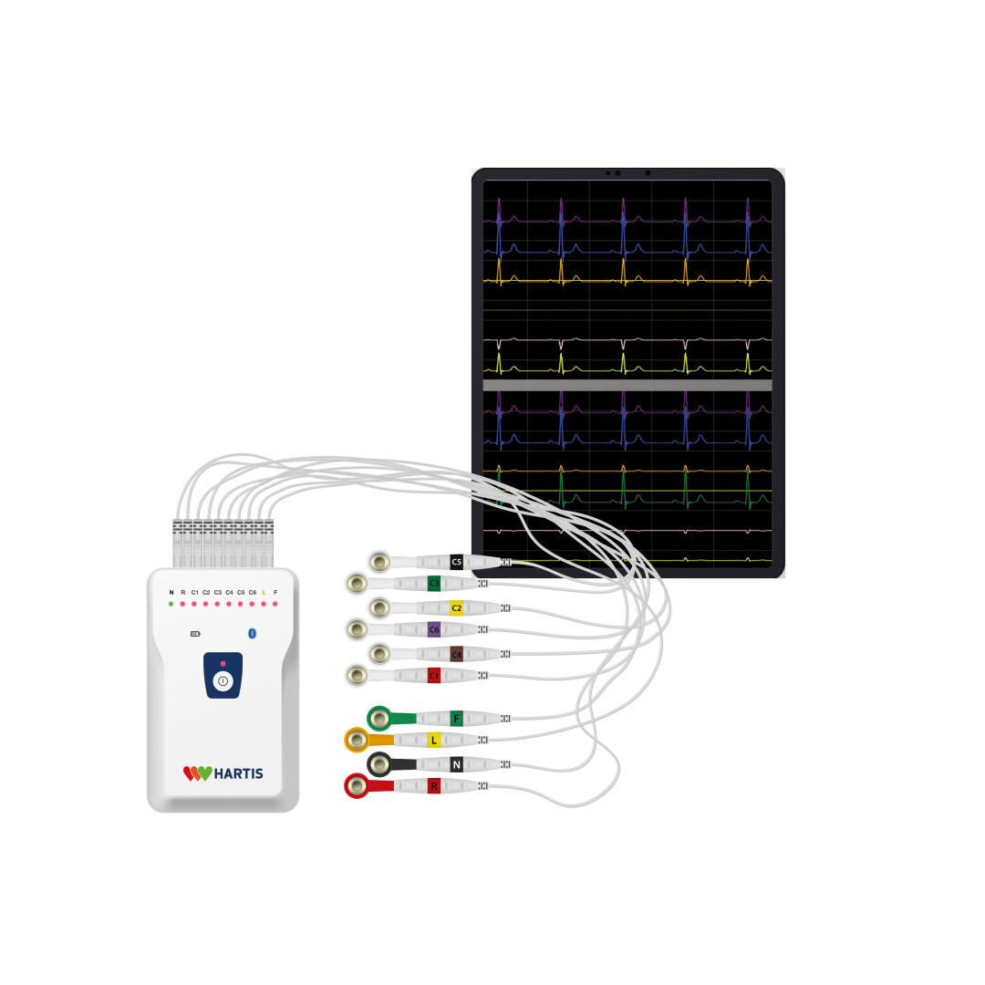 full-service-rust-ecg